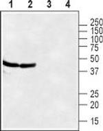 CXCR7 (ACKR3) (extracellular) Antibody in Western Blot (WB)