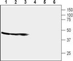 CRF1/CRHR1 (extracellular) Antibody in Western Blot (WB)