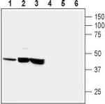 CRF1/CRHR1 (extracellular) Antibody in Western Blot (WB)