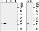 IBA1/AIF1 Antibody in Western Blot (WB)