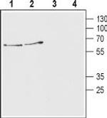 Vesicular Acetylcholine Transporter (VAChT) Antibody in Western Blot (WB)