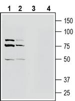 OCTN1/SLC22A4 Antibody in Western Blot (WB)