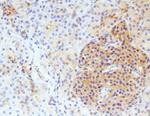 alpha Actinin 2 Antibody in Immunohistochemistry (IHC)