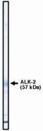 ACVR1 Antibody in Western Blot (WB)