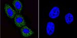 ARF1/ARF3/ARF5/ARF6 Antibody in Immunocytochemistry (ICC/IF)