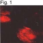 alpha-1a Adrenergic Receptor Antibody in Immunohistochemistry (IHC)