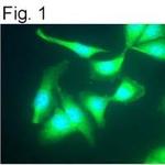 GRK2 Antibody in Immunocytochemistry (ICC/IF)