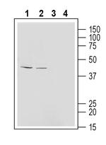 Endothelin Receptor B (extracellular) Antibody in Western Blot (WB)