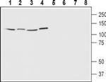 EphA1 (extracellular) Antibody in Western Blot (WB)