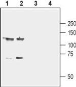 EphB1 (extracellular) Antibody in Western Blot (WB)