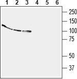 EphB4 (extracellular) Antibody in Western Blot (WB)