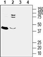 GPER1/GPR30 (extracellular) Antibody in Western Blot (WB)