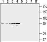 CD97/ADGRE5 (extracellular) Antibody in Western Blot (WB)