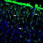 GFAP Antibody in Immunohistochemistry (Frozen) (IHC (F))