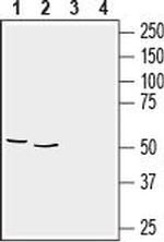 GFAP Antibody in Western Blot (WB)