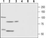 FSHR (extracellular) Antibody in Western Blot (WB)