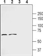 Frizzled-2 (FZD2) (extracellular) Antibody in Western Blot (WB)