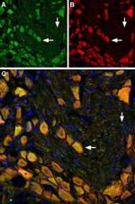 mGluR5 (extracellular) Antibody in Immunohistochemistry (Frozen) (IHC (F))