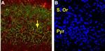 EAAT2 (GLT-1) (extracellular) Antibody in Immunohistochemistry (Frozen) (IHC (F))