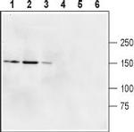 GRID2 (extracellular) Antibody in Western Blot (WB)