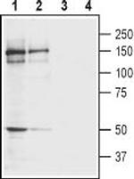 GRIK4 (KA1) (extracellular) Antibody in Western Blot (WB)