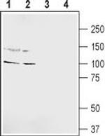 GRIK5 (GluK5) (extracellular) Antibody in Western Blot (WB)