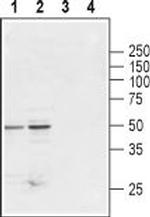 Glycine Receptor beta Antibody in Western Blot (WB)