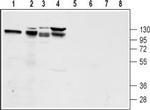 GLP1R (extracellular) Antibody in Western Blot (WB)