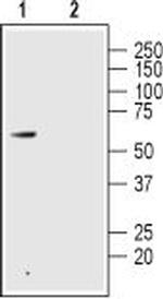 GLP2R (extracellular) Antibody in Western Blot (WB)