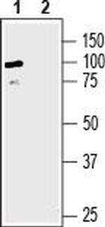 SLC6A8 Antibody in Western Blot (WB)