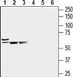 SLC6A8 Antibody in Western Blot (WB)