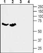 SLC6A7 (Proline Transporter) Antibody in Western Blot (WB)