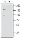 SLC6A15 Antibody in Western Blot (WB)