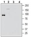 SLC6A15 Antibody in Western Blot (WB)