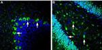 GLUT2 (SLC2A2) Antibody in Immunohistochemistry (Frozen) (IHC (F))