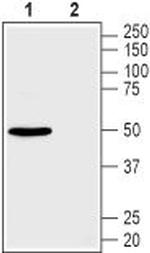 GLUT2 (SLC2A2) Antibody in Western Blot (WB)