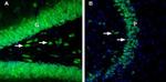 GLUT2 (SLC2A2) Antibody in Immunohistochemistry (IHC)