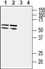 GLUT5 (SLC2A5) Antibody in Western Blot (WB)