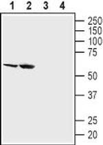 SGLT2 (extracellular) Antibody in Western Blot (WB)