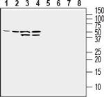 GLUT1 (extracellular) Antibody in Western Blot (WB)