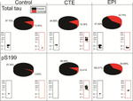 Phospho-Tau (Ser202, Thr205) Antibody in Western Blot (WB)