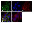 Tau Antibody in Immunocytochemistry (ICC/IF)