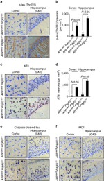 Tau (Cleaved Asp421, Asp422) Antibody in Immunohistochemistry (IHC)