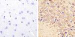 Tau (Cleaved Asp421, Asp422) Antibody in Immunohistochemistry (Paraffin) (IHC (P))