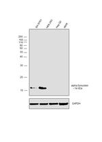 alpha Synuclein Antibody in Western Blot (WB)