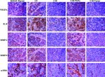 IL-8 (CXCL8) Antibody in Immunocytochemistry, Immunohistochemistry (ICC/IF, IHC)