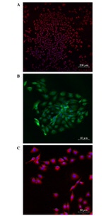 p53 Antibody in Immunocytochemistry (ICC/IF)