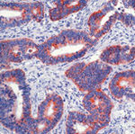 Paxillin Antibody in Immunohistochemistry (Paraffin) (IHC (P))