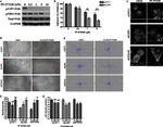 FAK Antibody in Immunocytochemistry (ICC/IF)