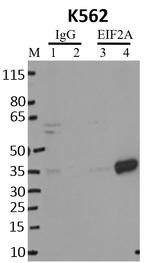 EIF2S1 Antibody in RNA Immunoprecipitation (RIP)